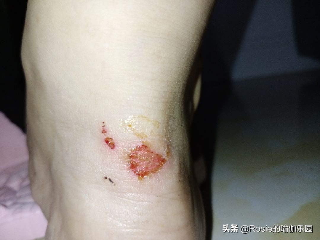 长时间穿高跟鞋脚疼怎么缓解,长时间穿高跟鞋脚肿怎么办