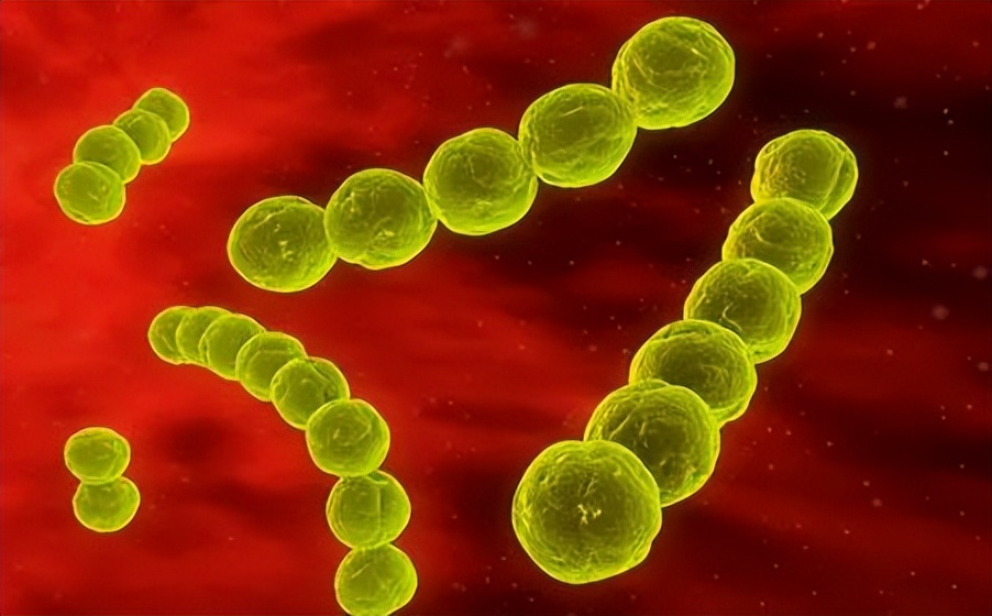 溶血链球菌引起风湿可以根治吗,风湿热溶血性链球菌