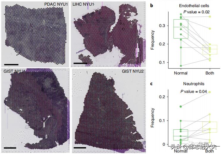 泛癌分析是怎么找到特定的基因的,癌细胞分析最新研究