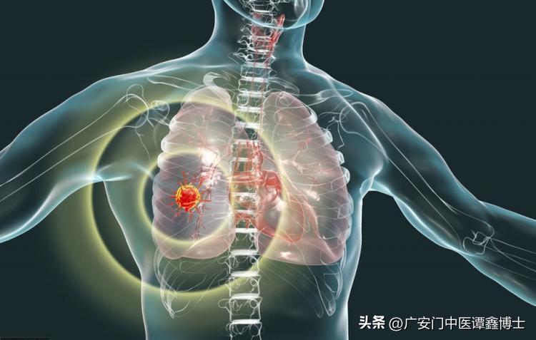 肺癌患者脸色黑皮肤有溃烂怎么办,肺癌晚期全身皮肤变黄什么原因