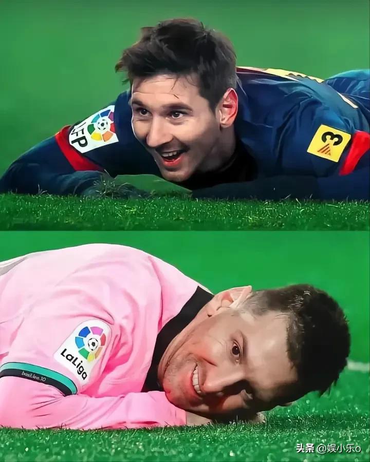 梅西侏儒症打了几针,梅西患侏儒症动画