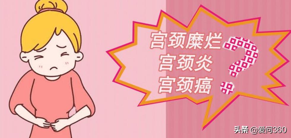 日常出现这些问题可能是宫颈炎,不要大意,做好预防措施