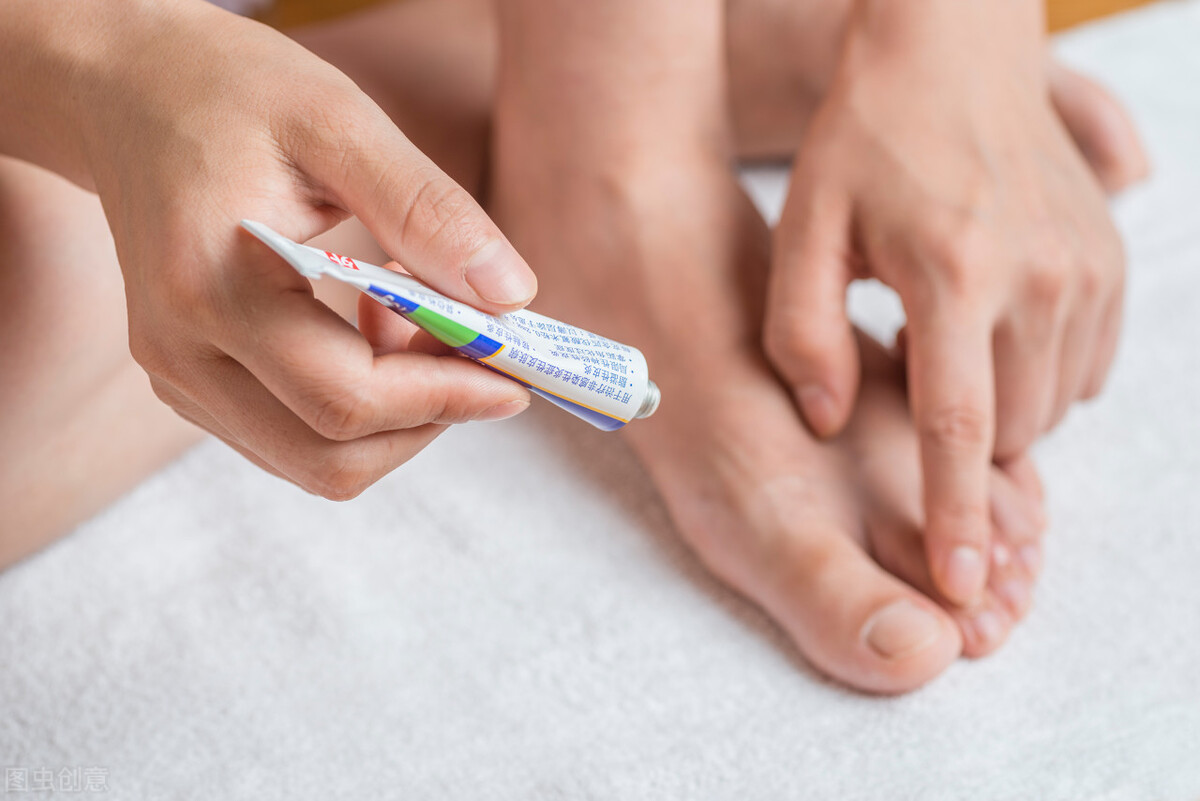 真菌手足癣用什么药最好,皮肤真菌感染用治脚癣的药