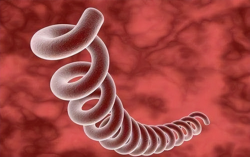 梅毒初期是什么症状梅毒怎么治,得了梅毒会有什么症状