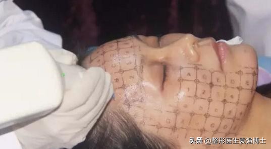 40岁面部皮肤松弛怎么紧致,40岁脸部松弛锻炼可以改善吗