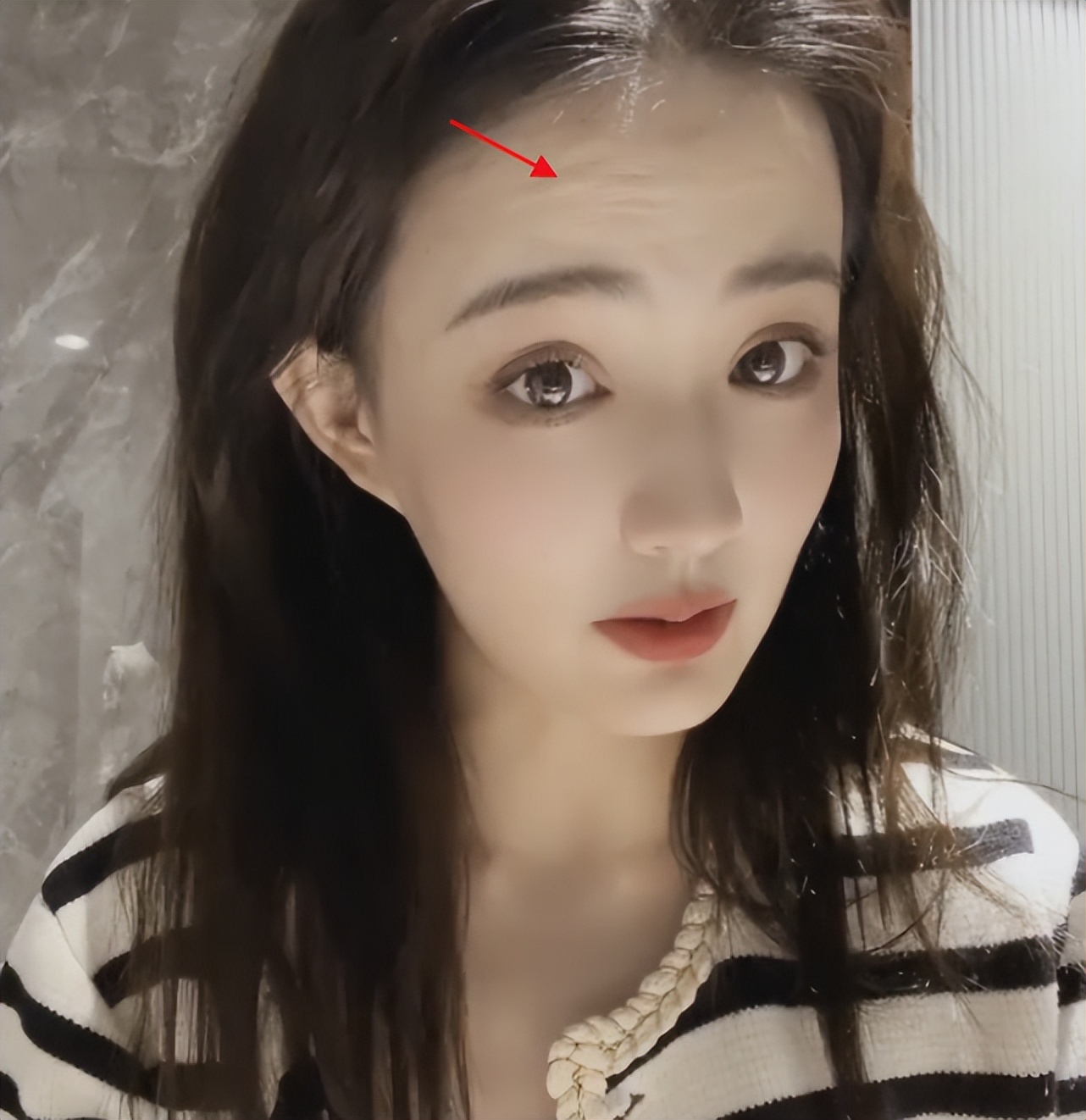 徐璐瘦的照片,徐璐抬头纹