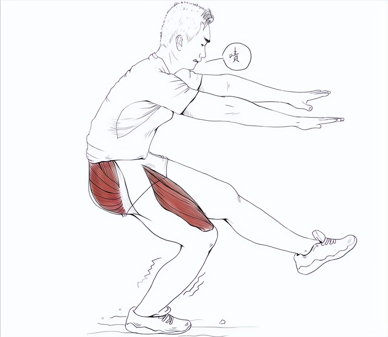 髌骨软化上楼膝盖疼能治好吗,髌骨软化症下楼梯膝盖疼怎么回事