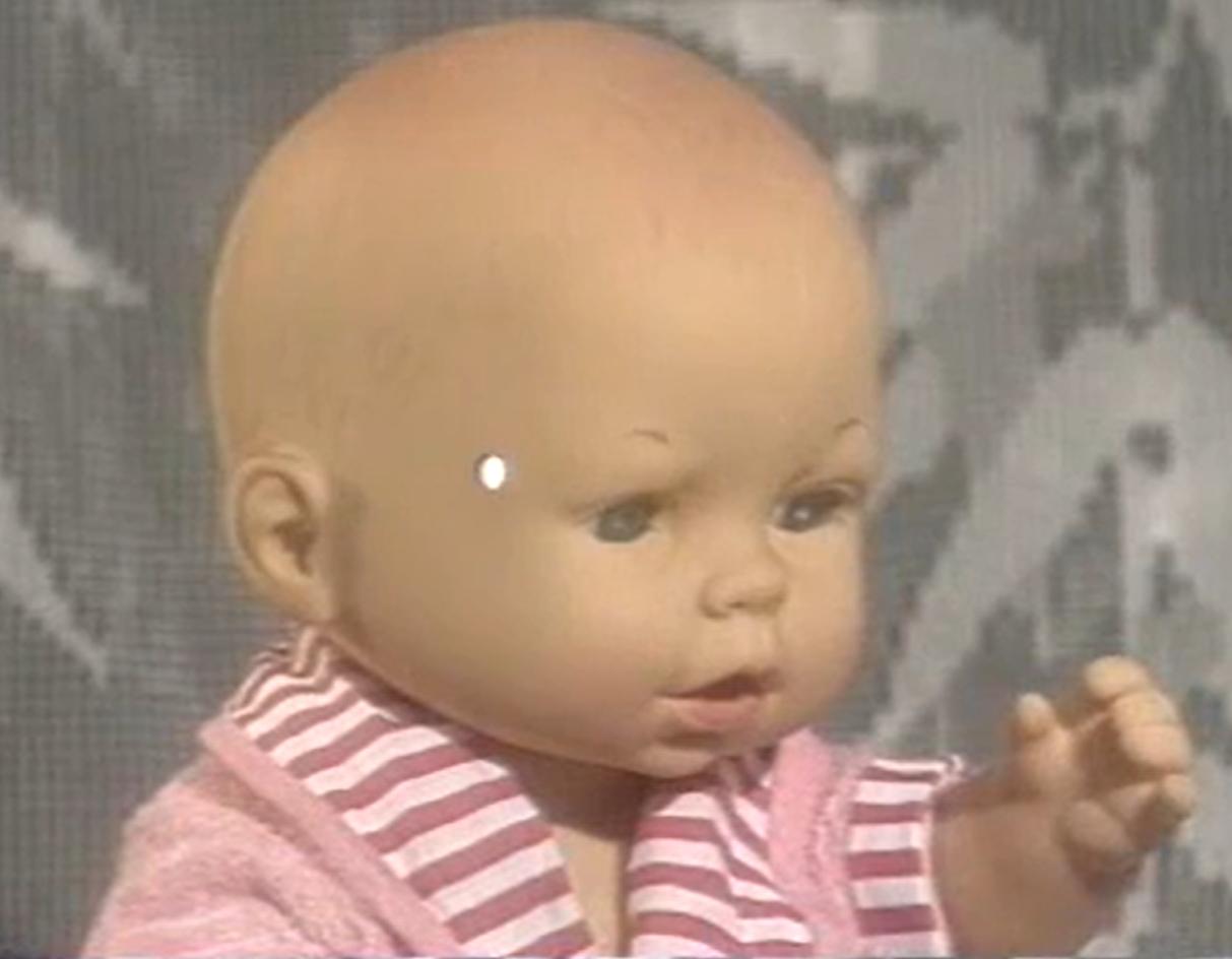 发热穴位小儿推拿,发热的小儿推拿退烧手法