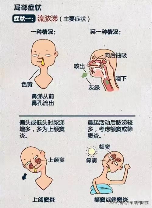 孩子反复咳嗽、鼻塞、流脓性鼻涕，以为是“感冒”？这都是鼻窦炎惹的祸！