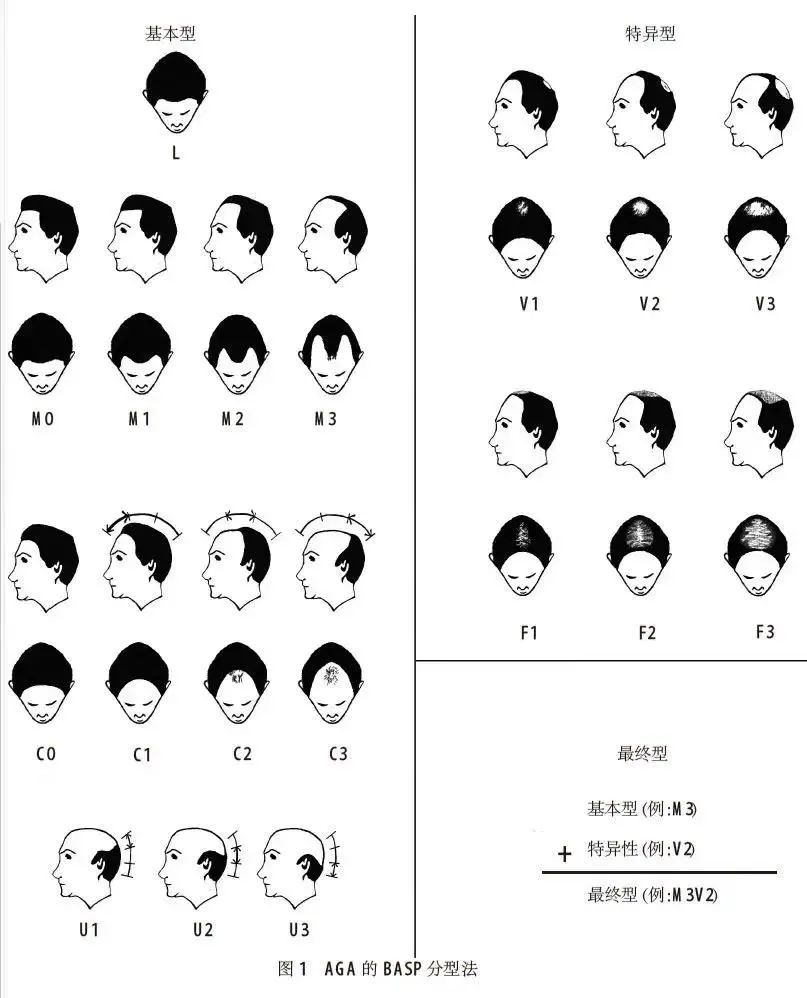 失眠头发掉得厉害是什么原因,秋天头发掉得厉害是什么原因