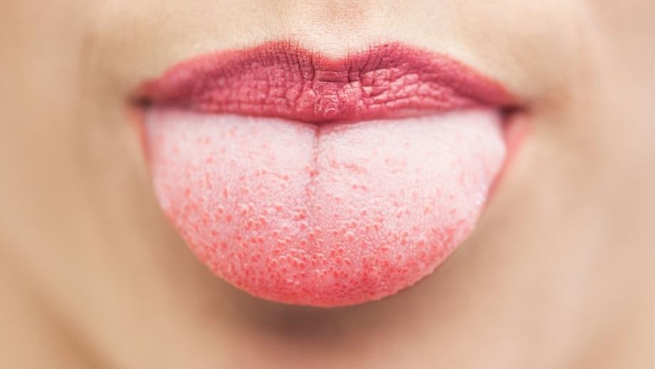 气虚出汗怕冷怎么调理,怕冷又爱出虚汗怎样调理