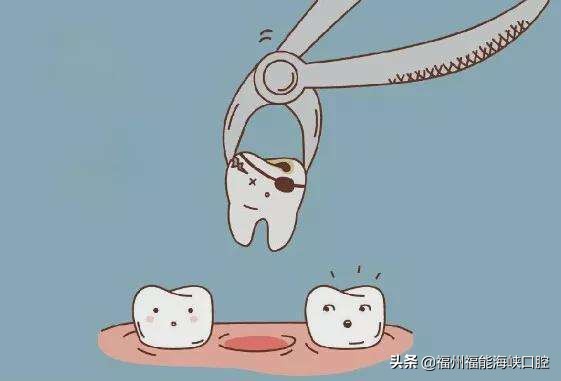 松动的智齿自己拔好还是医生拔好,松动的牙固定还是种牙好