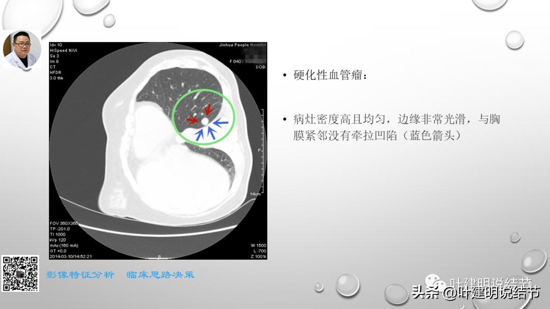 在《一脉阳光》呼吸影像诊断专题培训班上的讲课PPT（第一部分）