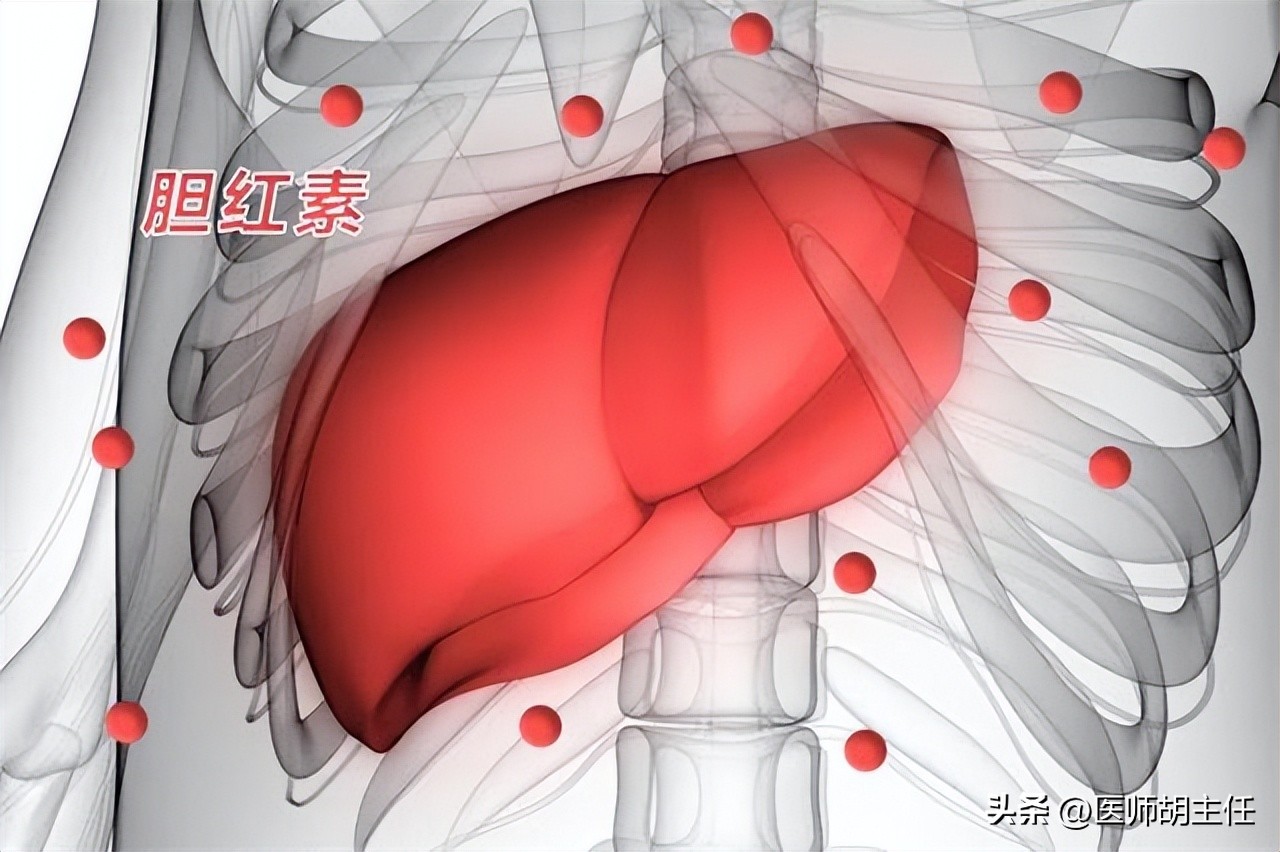 肝病胆红素偏高怎么才能降下来,体检胆红素偏高怎么快速降低