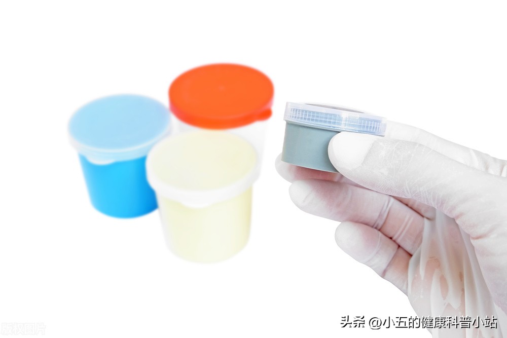 病毒性肺炎一直有白痰,病毒性肺炎咳出了白痰是好转了吗