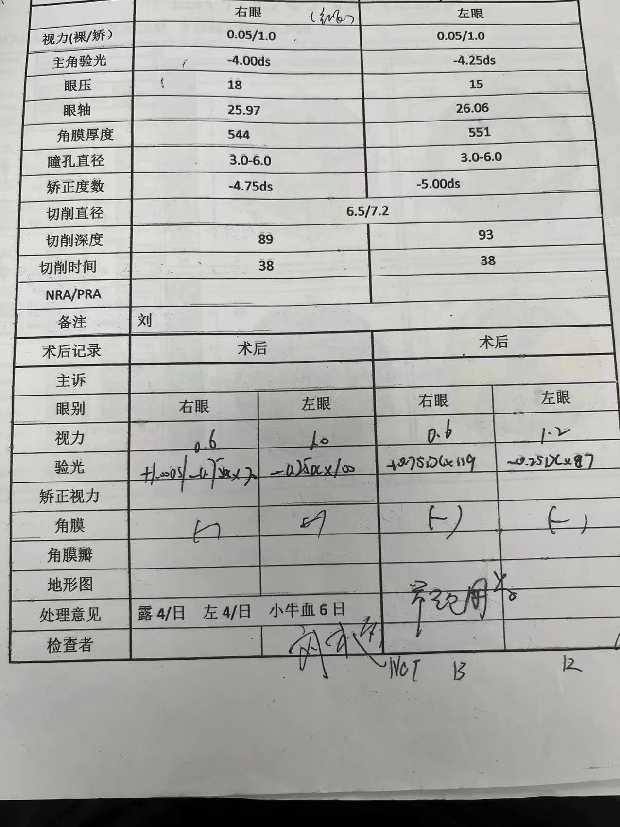 做黄斑裂孔手术是否能引起失明,女子做近视手术后又近视后续