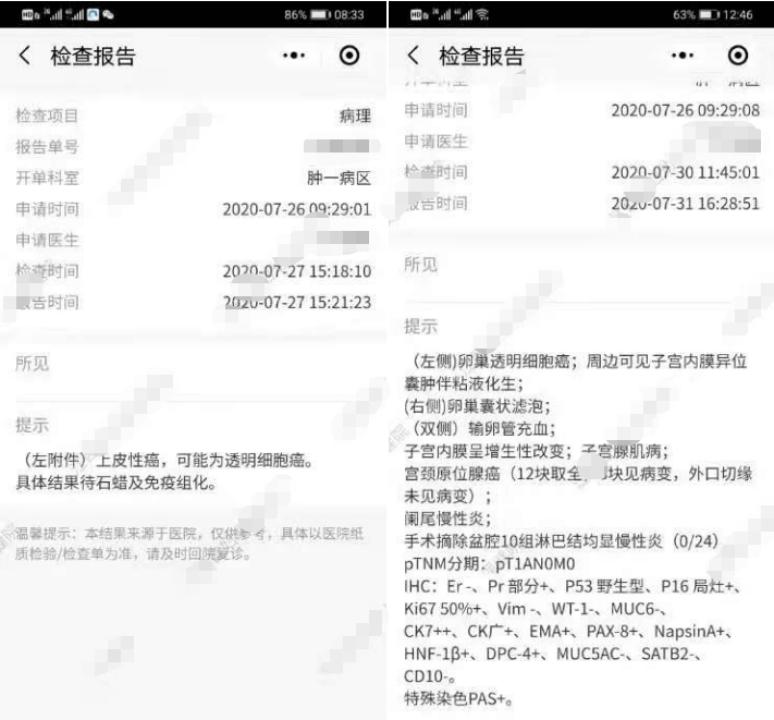 卵巢癌术后伤口疼是怎么回事,卵巢癌术后腰骶部疼