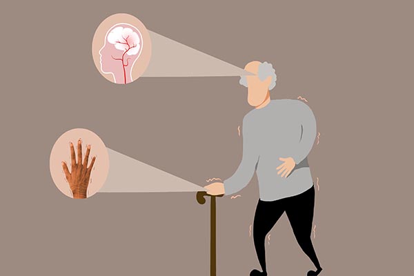 “神药”安宫牛黄丸，是中风患者的“续命丹”，还是“催命符”？