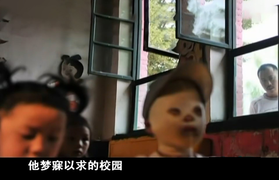 男孩因为烧伤惨遭毁容,被烧伤毁容的男孩