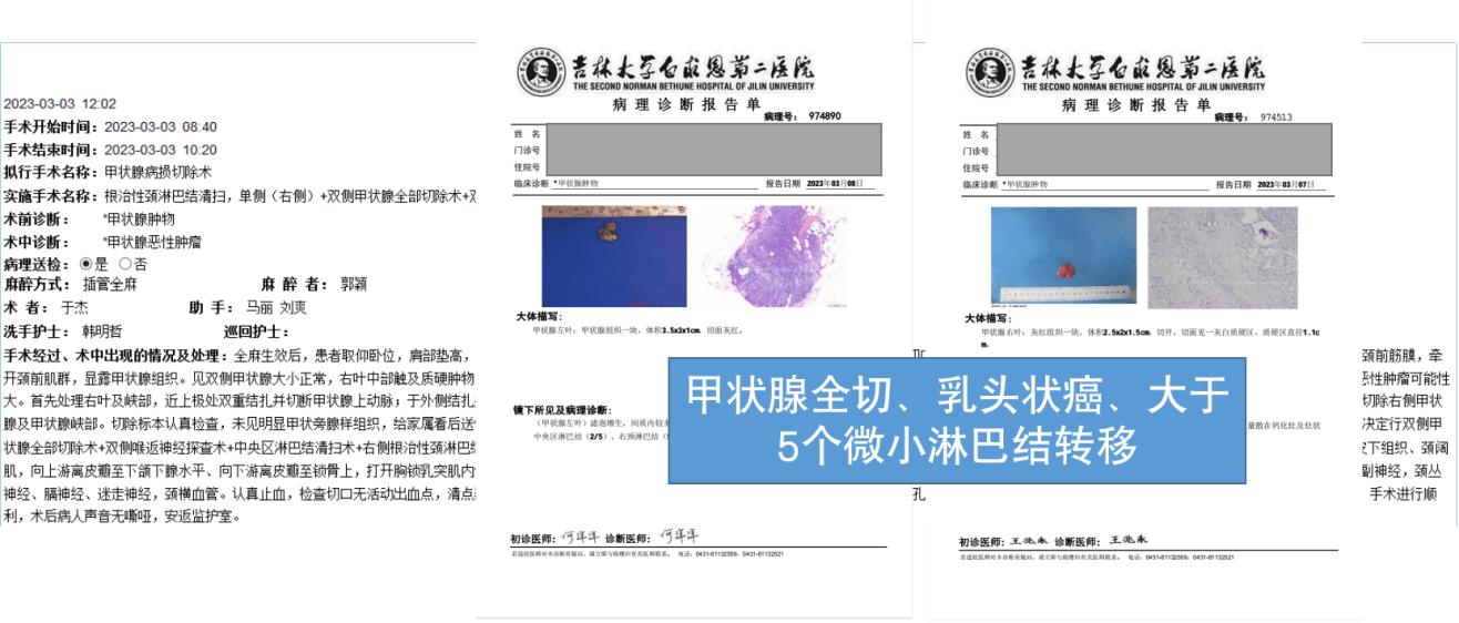 甲状腺术后需要忌碘吗,甲状腺术后忌碘