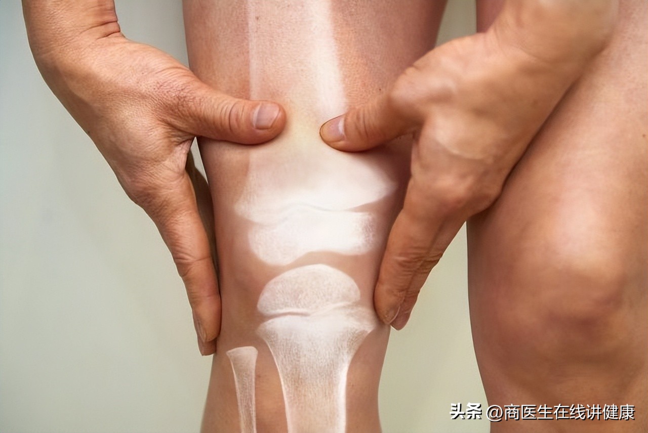 降糖药达格列净长期吃有什么害处,揭密降糖神药达格列净健康科普