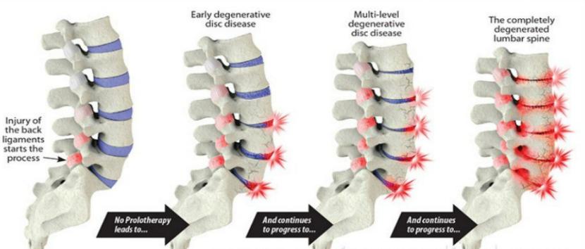 您的脊柱还好吗,健康的脊柱有多重要看完你就知道