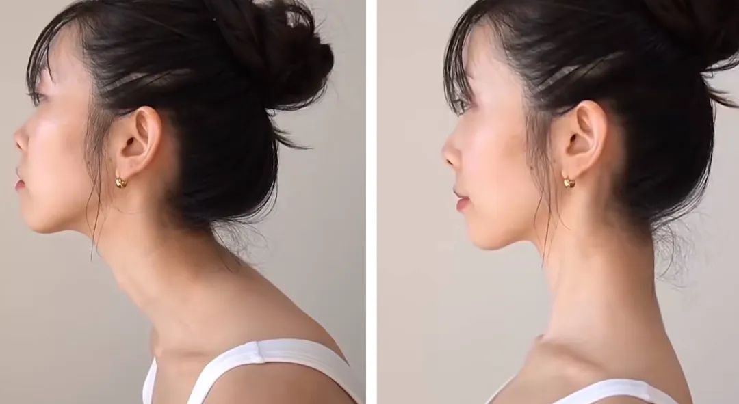 看起来胖实际没多重,胖有可能也是营养不良图文