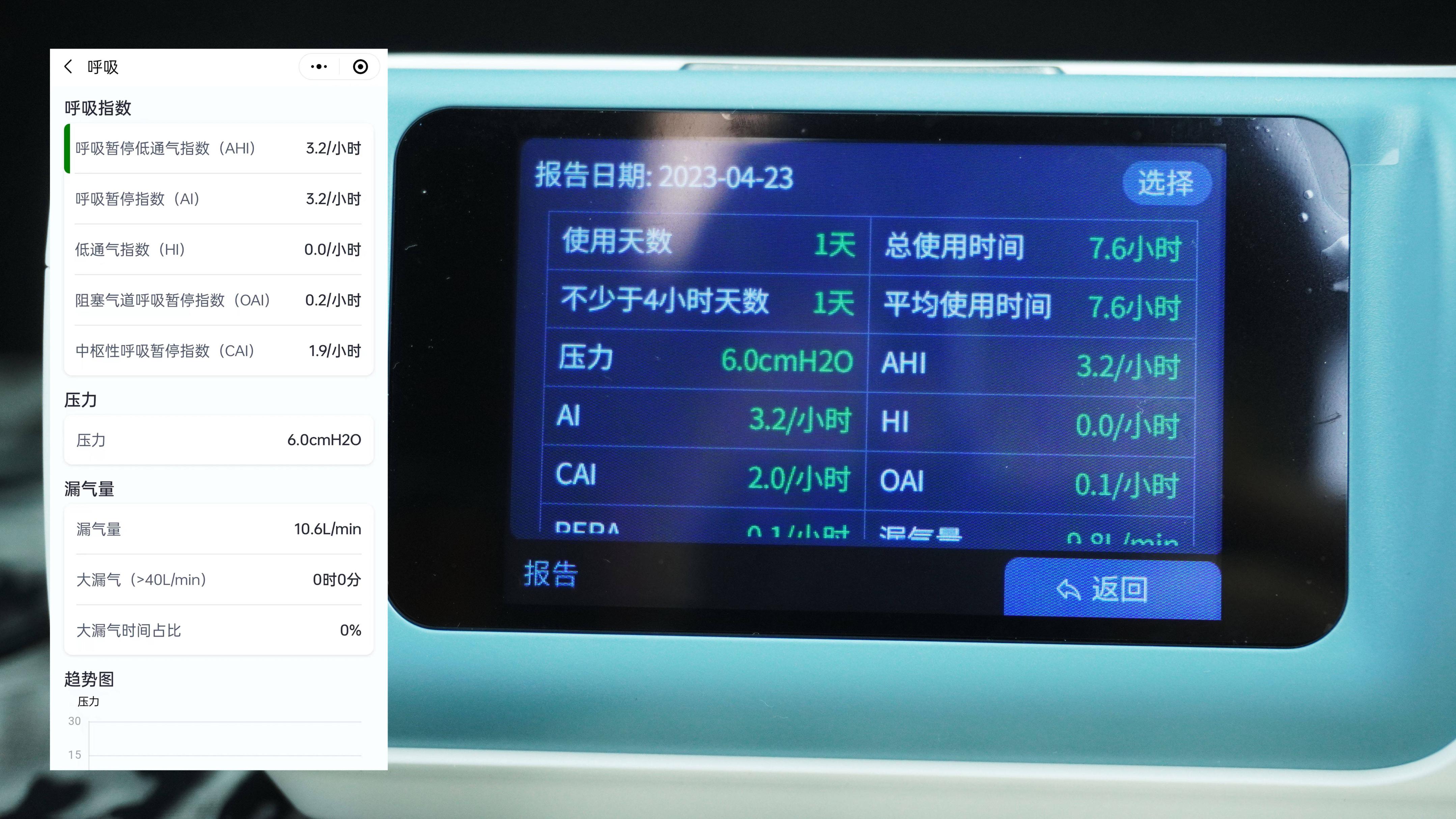 打鼾影响睡眠质量做什么手术,打鼾不仅影响他人还伤害自身