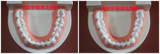 牙齿不好的人可以用电动牙刷吗,使用电动牙刷会导致牙齿过敏吗
