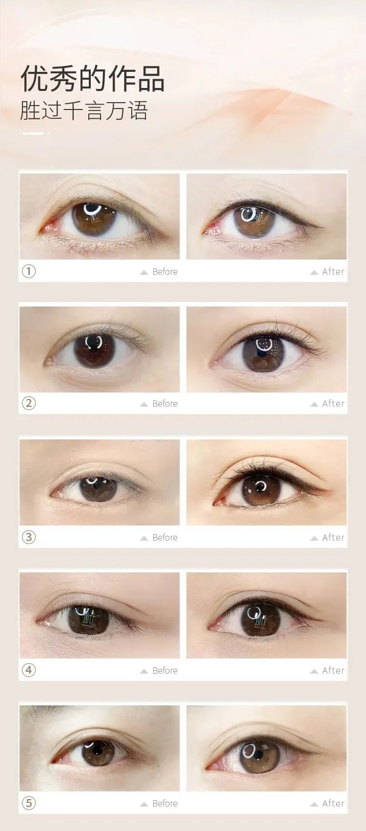 美瞳戴起来不痛吗,做美瞳线用什么舒缓乳不痛