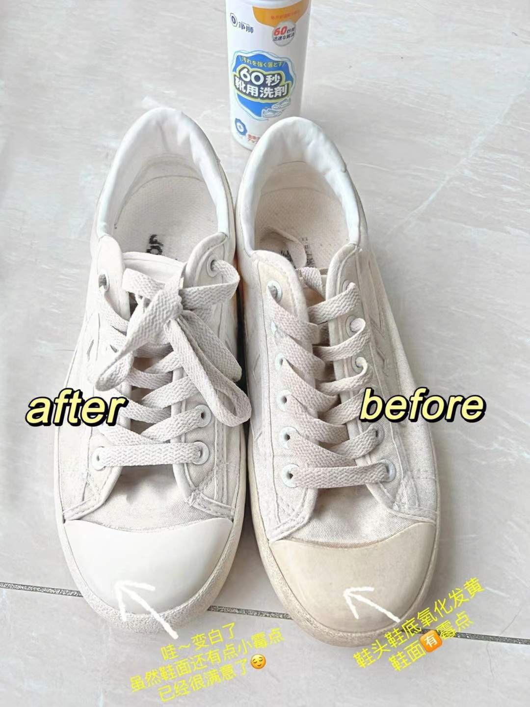 小白鞋脏了刷不下来有什么小妙招,小白鞋很脏怎么清洗没有白醋