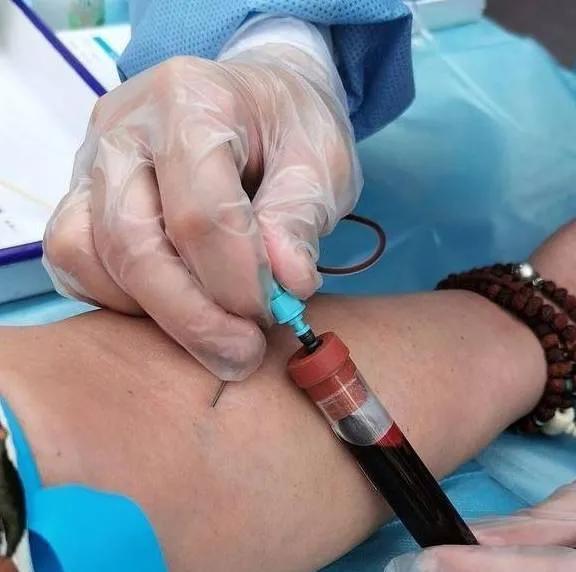 25岁女博士感染hpv,十七岁女孩感染hiv68阳怎么样转阴