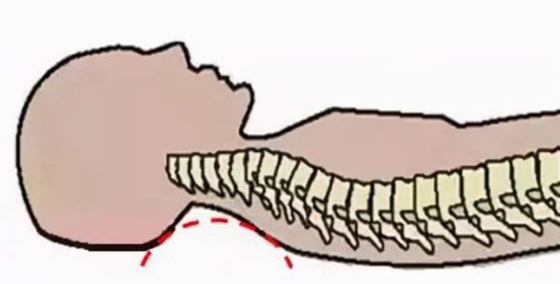 宝宝趴在枕头上对脊椎不好吗,宝宝能抱着睡吗会影响脊椎发育吗