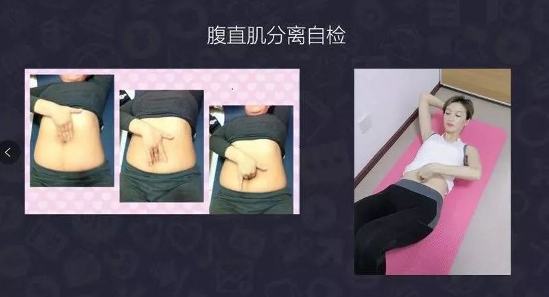 产后10个月漏尿怎么恢复,产后腰疼漏尿什么原因