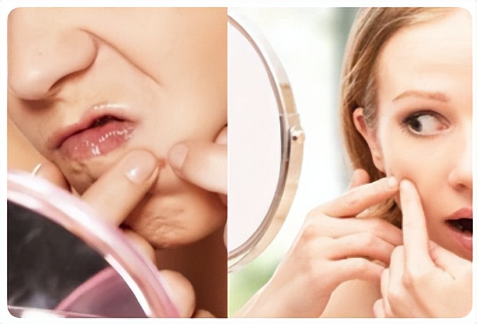 萃雪肤祛痘会不会烂脸,萃雪肤如何将脸上的毒排出来