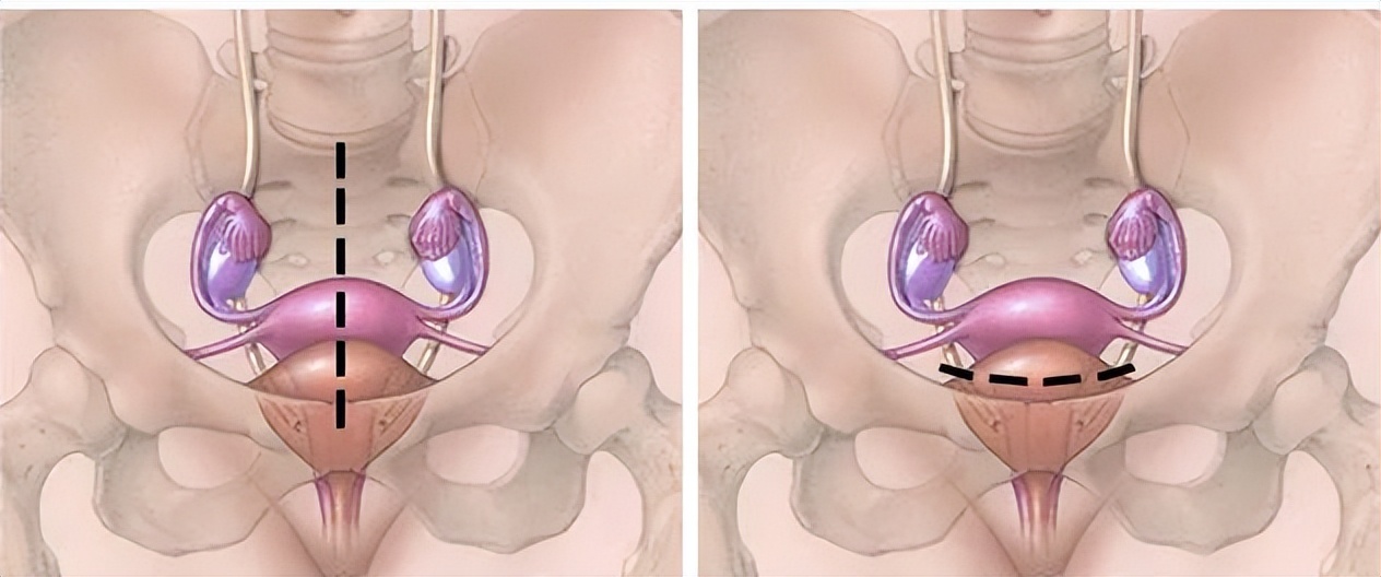 种草切子宫瘦小腹!没毛病吧,亲?