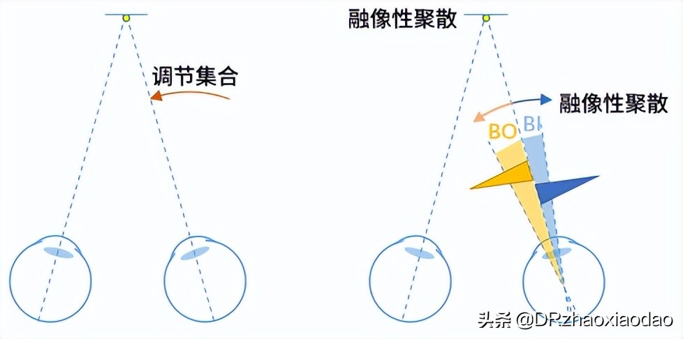 视功能和调节力报告解读