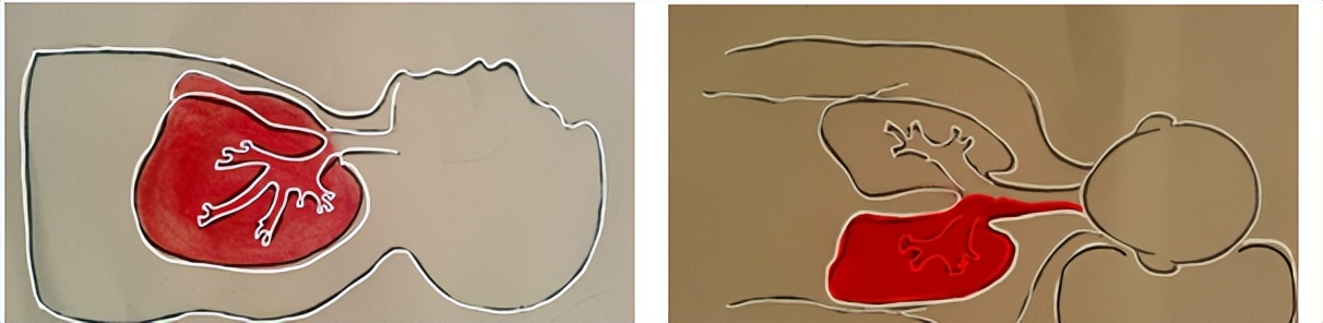 咯血一定要做支气管镜吗,支气管镜的注意事项