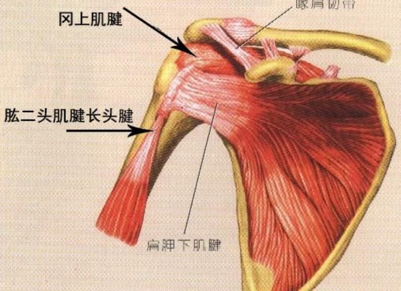 肱二头肌长头肌腱炎和肩周炎鉴别,肱二头肌肌腱炎用什么中药