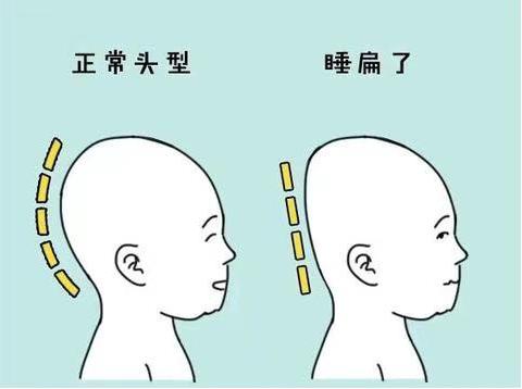 宝宝多大最容易睡偏头,宝宝头睡偏了会影响脸型么