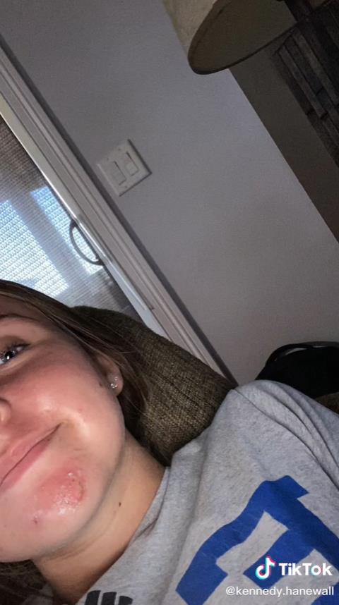 澳洲妹子和男友接吻,澳大利亚女子与男友接吻