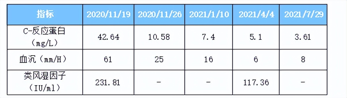 治疗类风湿性关节炎的象数疗法,类风湿关节炎指头肿怎么治疗