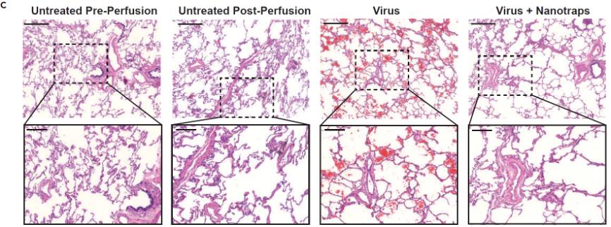 3i晶格光片显微镜助力新冠治疗纳米药物开发