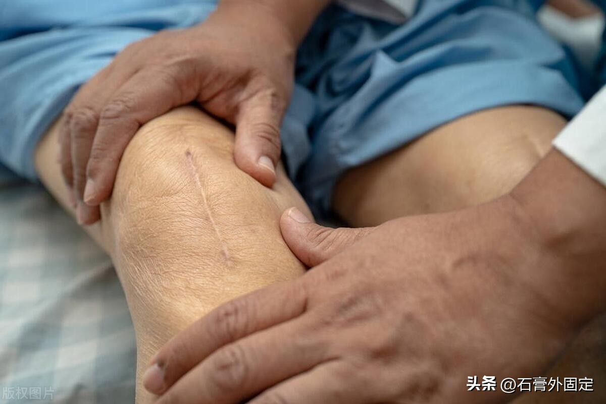 膝关节置换10年后注意什么,膝关节半月板置换后注意事项