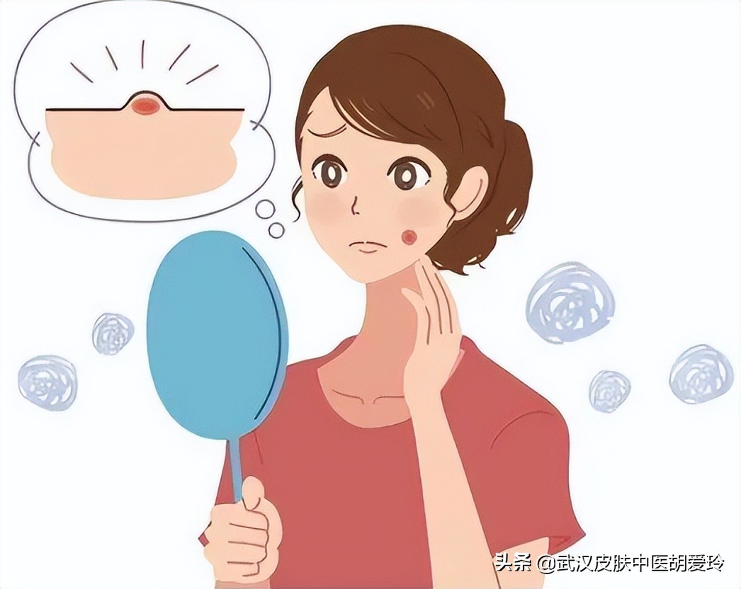 痘痘疼怎么回事,痘痘里有硬块不冒脓怎么办