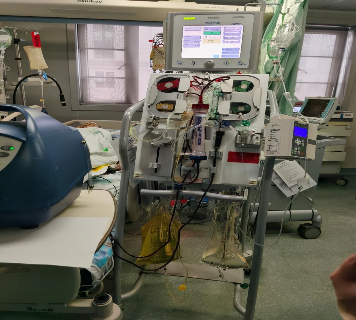 心脏切除一半怎么活,心脏摘除术