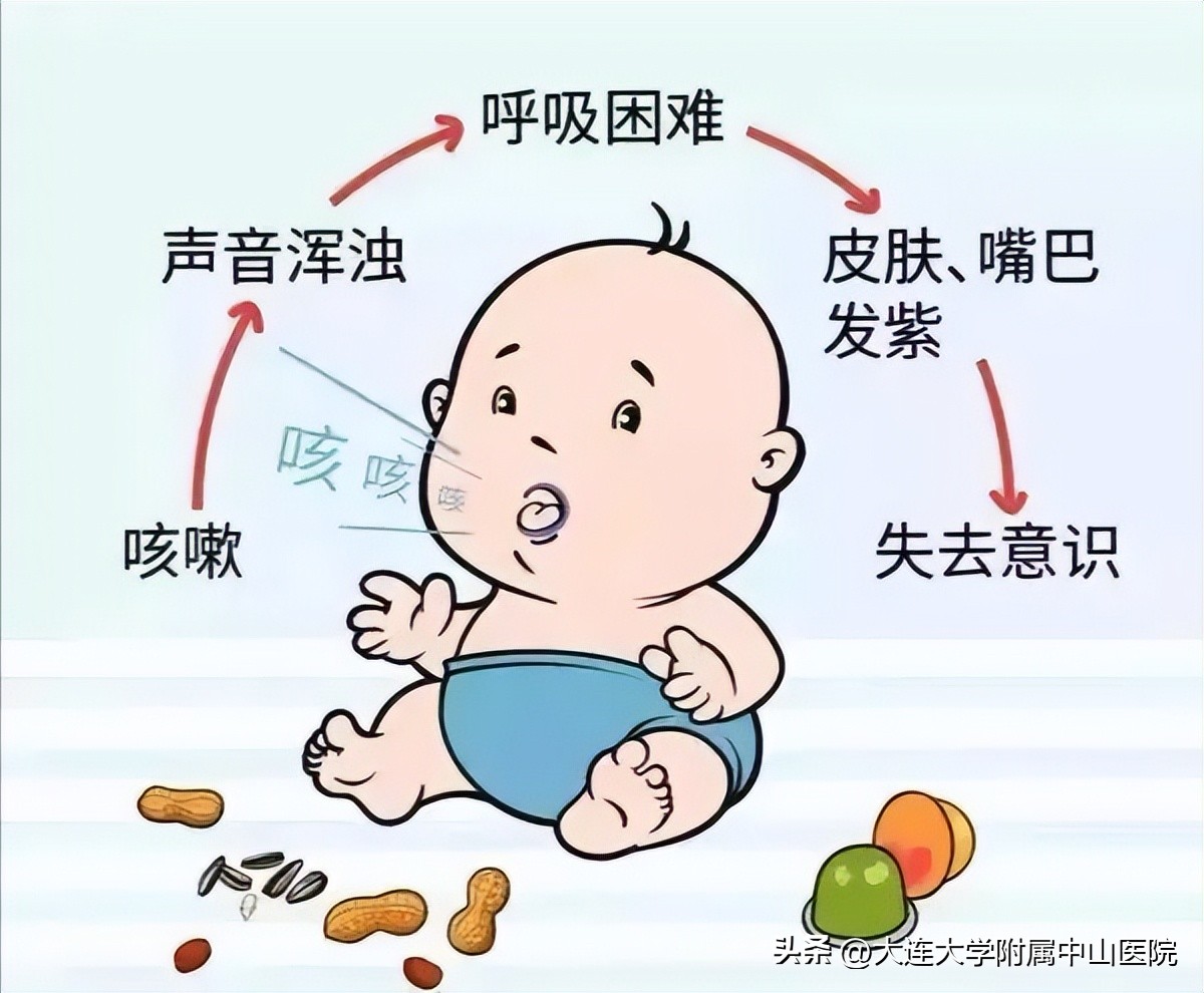 幼儿吞食异物的急救处理,儿童吞异物教育视频2岁