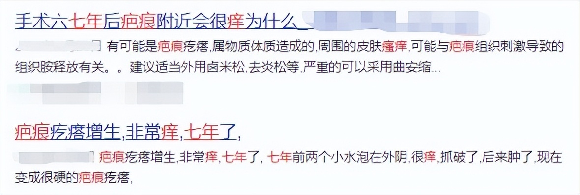 疤痕痛痒中医怎么治疗,疤痕痒怎么能彻底消除