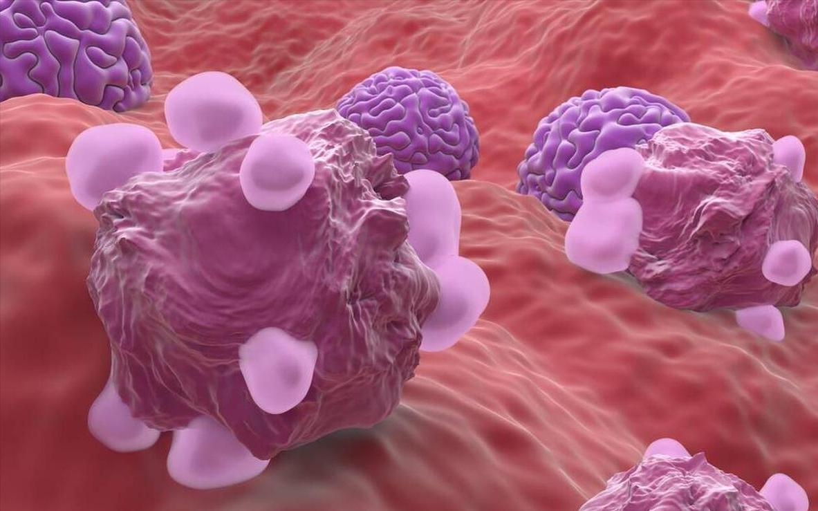 妇科专家外阴痒是什么原因,妇科潮湿是怎么回事