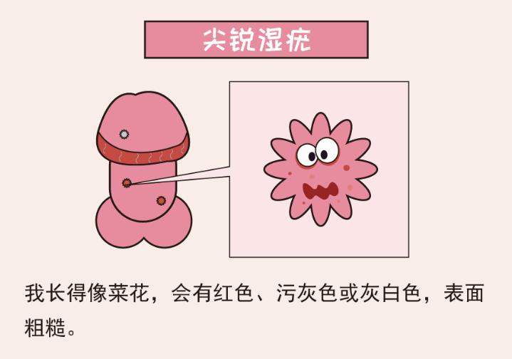 生殖器上长个疙瘩是什么性病,如何区别小疙瘩是不是性病